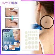 Jaysuing Skin Tag Patech - 144 Patech