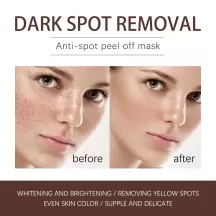 Jaysuing Anti-opot Peel Off Maks