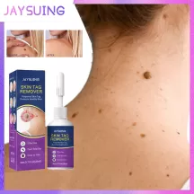 Jaysuing Wart Remover Liquid Skin Tag Removal