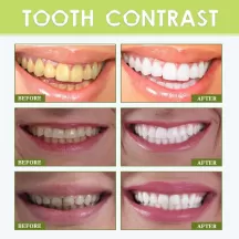 Teeth Whitening Stickers Cocoanut Oil