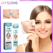 Jaysuing 7 Days Acne Control Gel - 20ml