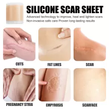 Jaysuing Silicone Scar Sheets