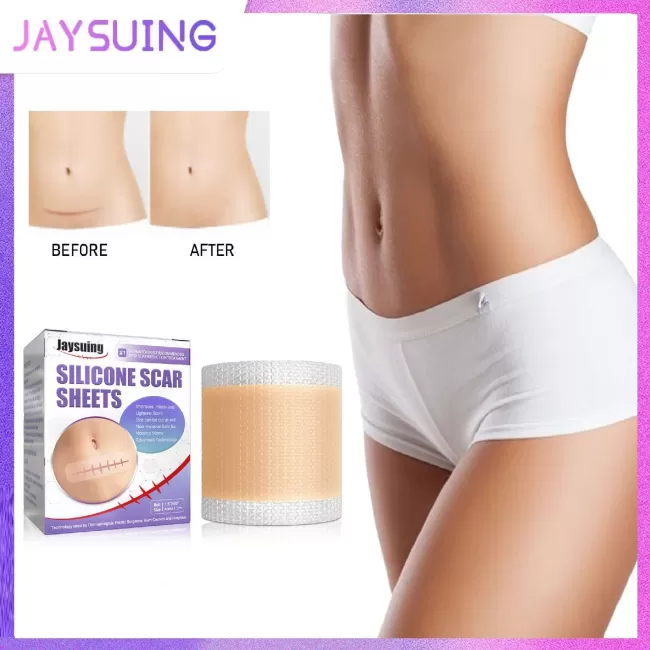 Jaysuing Silicone Scar Sheets