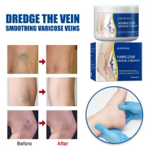 Jaysuing Varicose Vein Cream