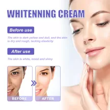 Jaysuing Whitening Cream Face