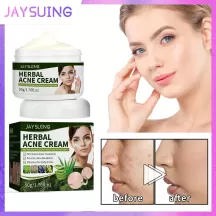 Jaysuing Herbal Acne Removing Cream