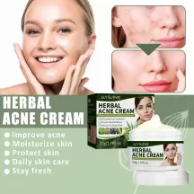 Jaysuing Herbal Acne Removing Cream