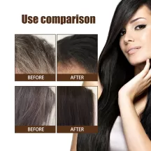 Jaysuing Anti White Hair Spray Hair Growth Black Repair Serum