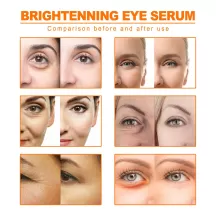 Jaysuing Vitamin C Remove Dark Circles Eye Serum