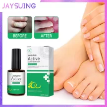 Jaysuing Wart Corns Remover Gel