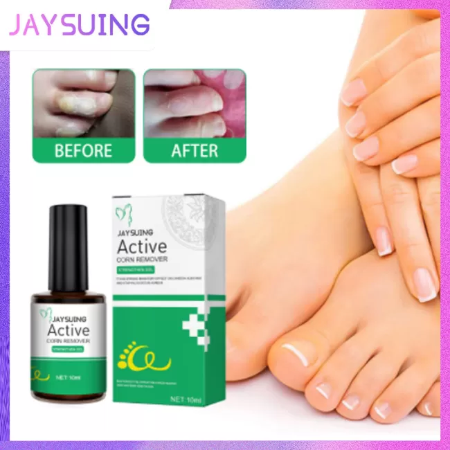 Jaysuing Wart Corns Remover Gel