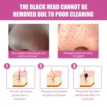 Jaysuing Aloe Vera Blackhead Removing Glue