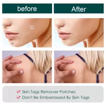 Jaysuing Skin Tag Removal Patch