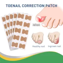 Jaysuing Nail Correction Stickers Ingrown Toenail Patche