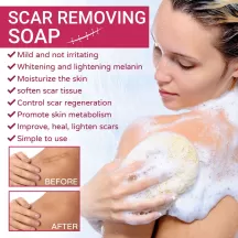 Jaysuing Scar Removal Soap Stretch Marks