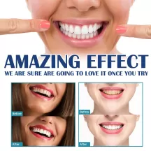 Jaysuing Teeth Whitening Paint