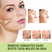 Jaysuing Mole Removal Serum Non-marking