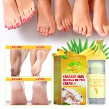 Jaysuing Foot Crack Cream Banana Moisturizing