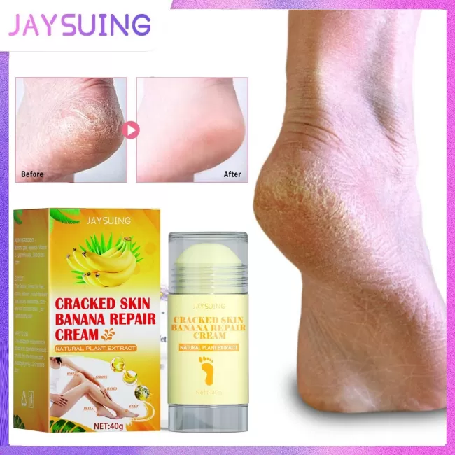 Jaysuing Foot Crack Cream Banana Moisturizing