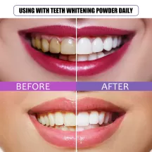 Jaysuing Teeth Whitening Powder Baking Soda