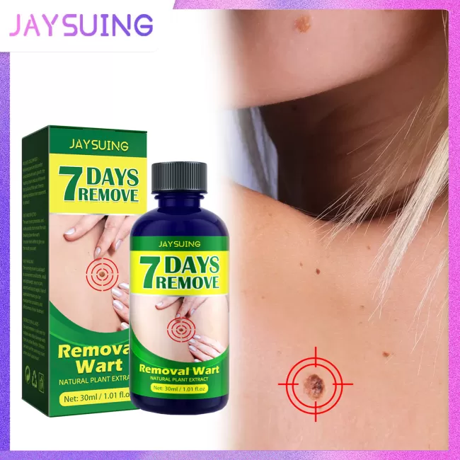 Jaysuing Wart Remover Liquid Painless Treatment Meat Corn Skin Flat Wart