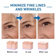 Jaysuing Wrinkle Remover Serum