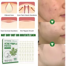 Jaysuing Acne Pimple Patch