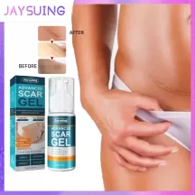 Jaysuing Scar Removal Gel