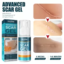 Jaysuing Scar Removal Gel