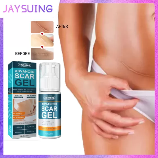 Jaysuing Scar Removal Gel