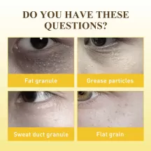 Jaysuing Fat Granules Removal Eye Cream