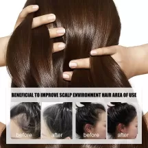 Jaysuing Hair Growth Essence Growing Anti Hair Loss