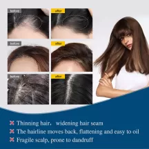 Jaysuing Hair Growth Essence Growing Anti Hair Loss