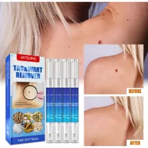 Jaysuing Wart Remover Skin Tag Removal Pen