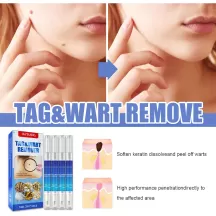 Jaysuing Wart Remover Skin Tag Removal Pen