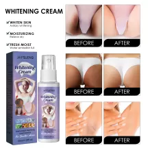 Jaysuing Body Whitening Cream Remove Dark Legs Knees