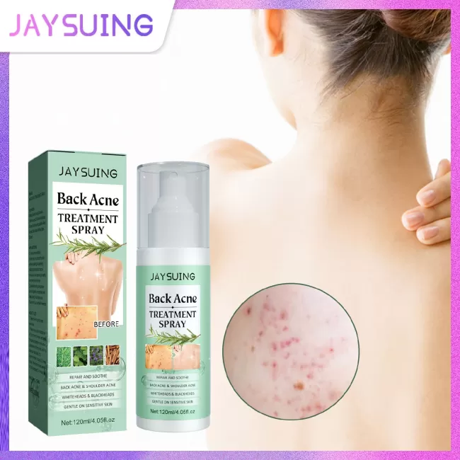 Jaysuing Back Acne Treatment Spray