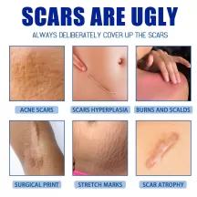 Jaysuing Scar Removal Cream Stretch Marks