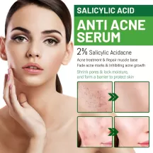 Jaysuing Acne Treatment Face Serum