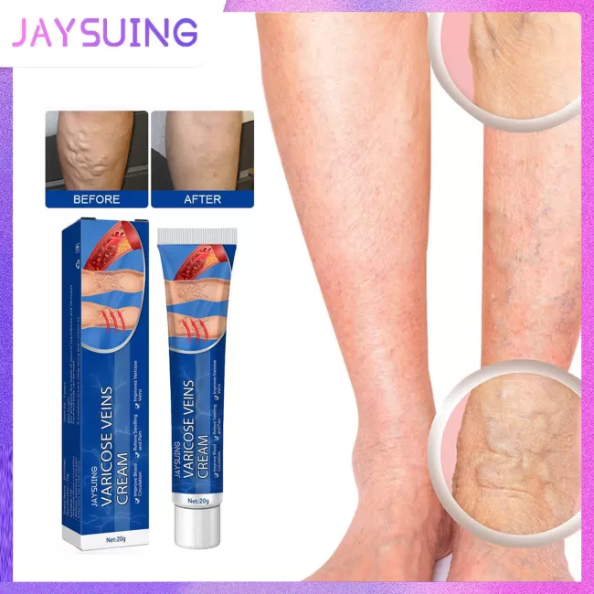 Jaysuing Varicose Vein Cream