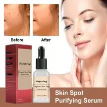 Jaysuing Organic Skin Tag Solutions Serum