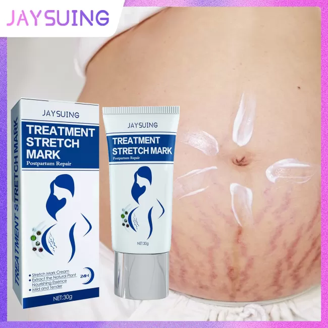 Jaysuing Stretch Mark Removal Cream