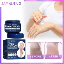 Jaysuing Urea Crack Cream