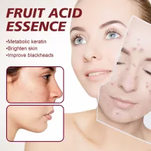 Jaysuing Fruit ACID Essence