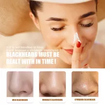 Jaysuing Blackhead Remover Cream