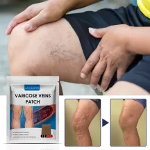 Jaysuing Varicose Vein Relief Patch