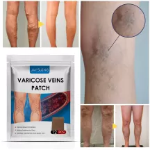 Jaysuing Varicose Vein Relief Patch