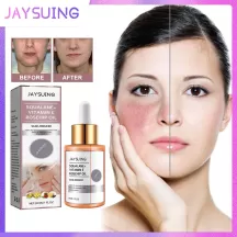 Jaysuing Scar Removal Rosehip Oil