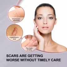 Jaysuing Scar Removal Rosehip Oil