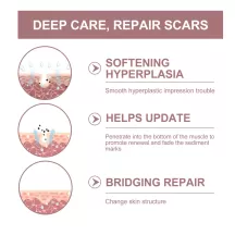 Jaysuing Scar Removal Rosehip Oil